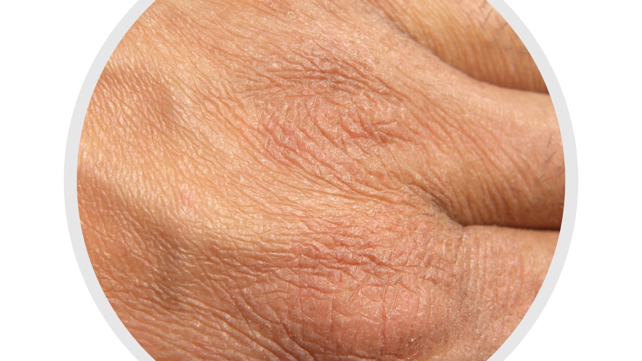 Regeneracja skóry twarzy i rąk po długotrwałym stosowaniu środków ochrony indywidualnej i dezynfekujących.